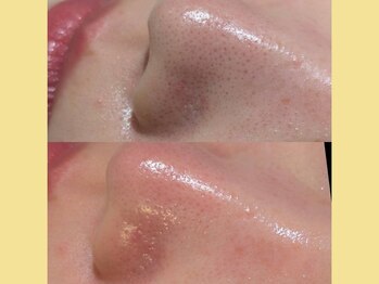 モストアイズ 岡崎店(most eyes)/フェイスワックス鼻/Honda