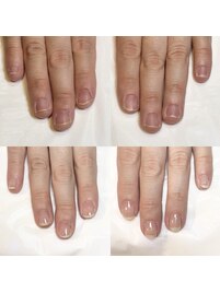 短くしても縦長の美しい爪に！