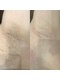 ナンバーサーティーン(NUM13ER)の写真/全身脱毛が都度払いOK!経験豊富なスタッフによる丁寧な施術で、脱毛初心者さんも自信が持てるお肌へ!