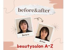 アーズ(A-Z)/究極の顔面デトックス