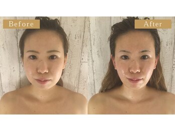 モモスパ(MOMOspa.)/頭蓋骨小顔矯正ビフォアフター