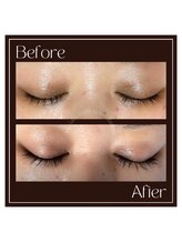 ラノン(Ranon)/エグータムBefore／After(1)