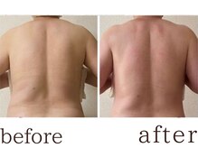 フォー(For...)/リンパマッサージ◇天王寺