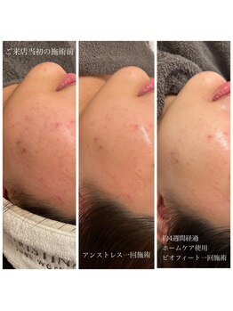 エクラ(eclat)/クリスティーナ