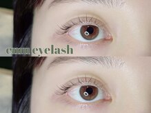 エム アイラッシュ(emu eyelash)