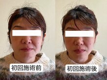 すわ鍼灸整骨院の雰囲気（【大人気★美容鍼灸（通電付）】1回でも効果実感と喜びの声多数）