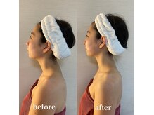 ココ 宮崎店(COCO)の雰囲気（デコルテマッサージでストレートネックも改善☆お首の長さ大事！）