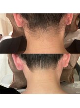 メルシートータルビューティー(MERCI)/初めての方もリピーター様も脱毛