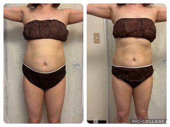 ヨサパーク ケリビオラ(YOSA PARK keli美ola)/水素酸素吸入をプラス