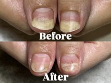 結(Yui)/爪の悩み、育成で解決