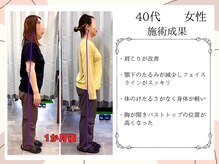 イルミナ(illumina)/40代　女性　運動療法成果