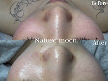 ナチュールムーン(Nature moon.)/毛穴洗浄