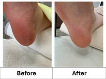 ドクターネイル爪革命　苫小牧店【巻き爪・魚の目・タコ・フットケア専門店】の雰囲気（足元のお悩み、お任せください！）