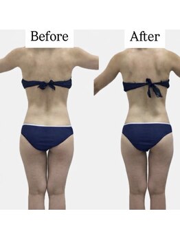 ラヴィ(Ravi)/デトックス骨格痩身コース90分