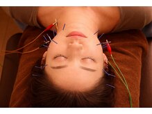 カラダリセット 上本町/美容鍼灸の様子です♪