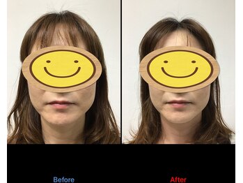 整体カワハラ(KAWAHARA)/【小顔整体】　美容整体