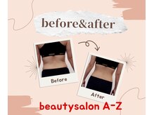 アーズ(A-Z)/お腹/背中/腰肉の脂肪スッキリ