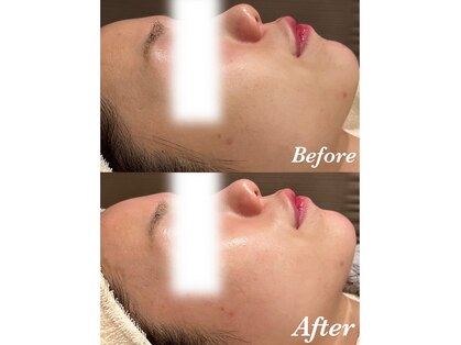 アンフィズム フェイシャル 麻布十番店(annfism facial)の写真