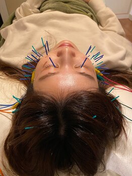 ラパアウ(Lapa`au)/美容鍼