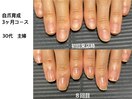 【自爪育成】3ヶ月コース