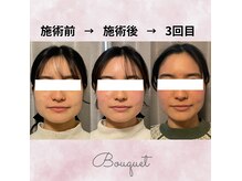 ブーケ(Bouquet)の雰囲気（どこに行っても解決できなかったお悩み！お任せください♪）