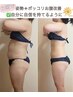 【5名限定★ダイエットリカバリー】35歳からの大人痩身|無理なく痩せ体質へ