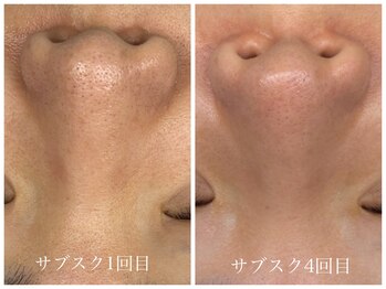 ヴェーラベレッツァ(Vera Bellezza)/