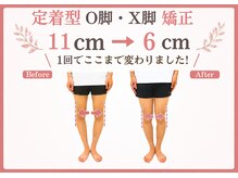 整体院がく 前橋駒形院