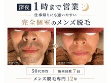 カイ メンズ脱毛アンドネイル(KAI)