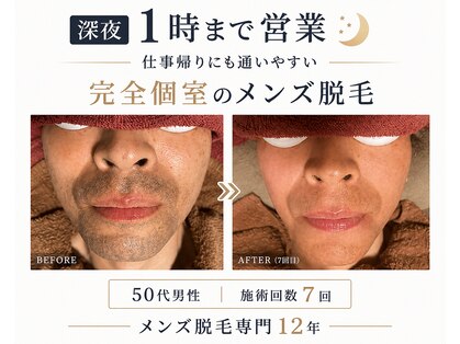 カイ メンズ脱毛アンドネイル(KAI)の写真