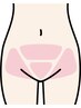 ゼットワン脱毛【VIO　5か所】初回価格￥5.500
