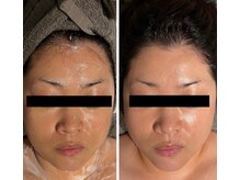 シロトータルデザイン(shiro total design)/ウルトラフェイスリフト