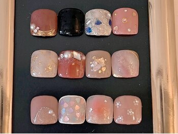 フット親指定額コース