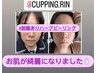 本気肌質改善ハーブピーリング¥38980円→¥28980  Cupping.rin Guasha. rin 