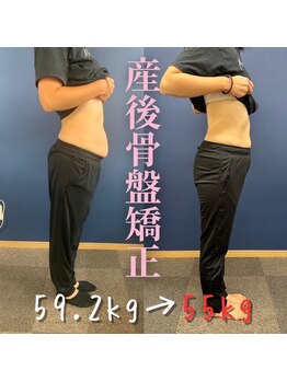 こうぞう整体院/産後骨盤ダイエット