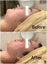 スペチアーレ 夙川/小顔と美肌が手に入る