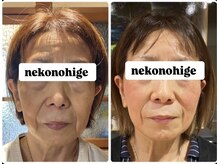 ねこのひげ/お顔の変化