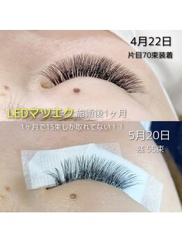 バタフライジュエル 広島店(ButterflyJewel)/LEDのモチの良さ実感ください♪