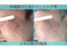 リメイククリニカルビューティー(Remake clinical beauty)/