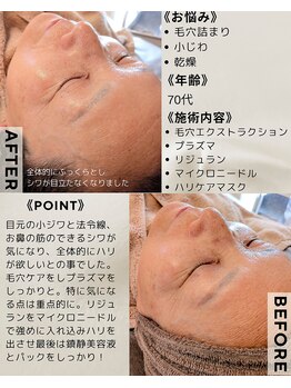 サロン ザ プマロ(SalonThePumalo)/ハリの最強ケア