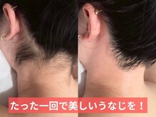 エースター(A-star)