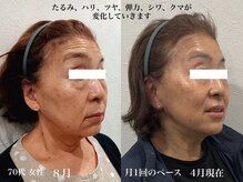 スキンスタジオ レア(Lea)の雰囲気（肌の奥からうるおいと弾力がよみがえる最高のたるみ、お肌ケア！）