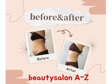 アーズ(A-Z)/食事とキャビゼロで大変身。