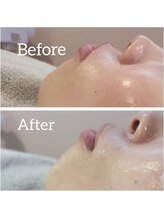 チル アウト(CHILL OUT)/Jet Peel　ぷる艶リップ