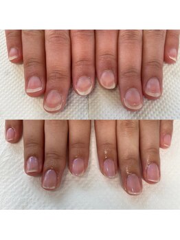 産後の荒れたお手元が美爪へ