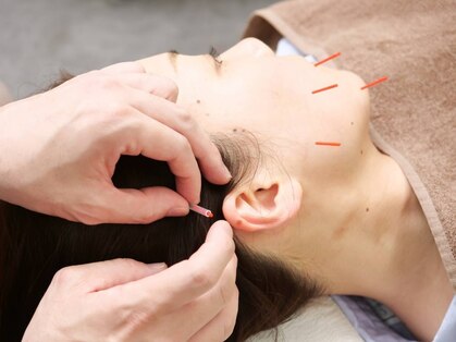 ジョイプラス川西鍼灸整骨院(joyplus.川西鍼灸整骨院)の写真