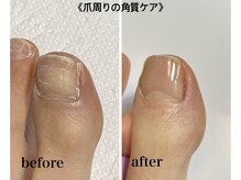 ティーラ ネイル(Thira nail)の雰囲気（フットジェル&ケア全コース爪周り角質ケア付◎中目黒パラジェル）