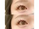 モアビューティ 光町店(MORE BEAUTY)の写真