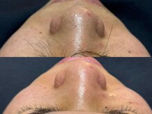 リアン 本町(Lien.)/黒ずみも一回でこんなに！？