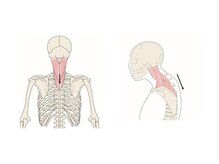 最終形美/姿勢の崩れからくる筋肉の凝り